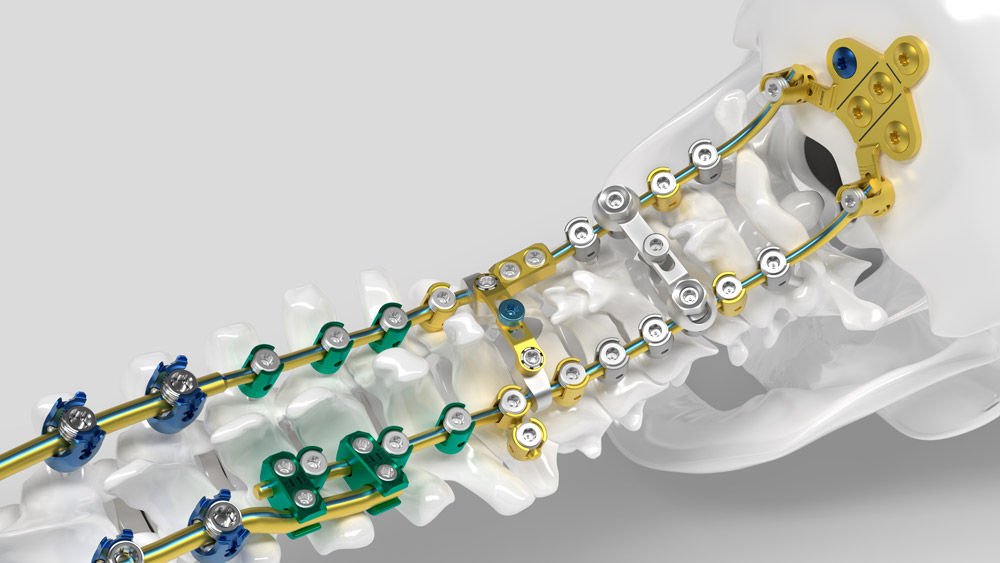 Chirurgický modul Ennovate® Cervical