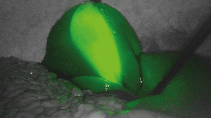 FI green – technológia 3D fluorescenčného zobrazovania