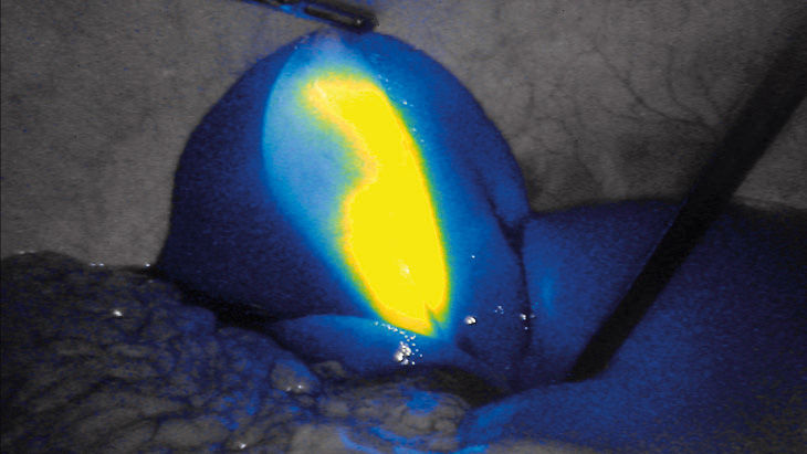 FI intensity– technológia 3D fluorescenčného zobrazovania