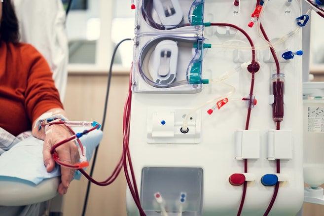 žena v strednom veku má ruku položenú v blízkosti zdravotníckej pomôcky a dostáva lieky cez niekoľko katétrov